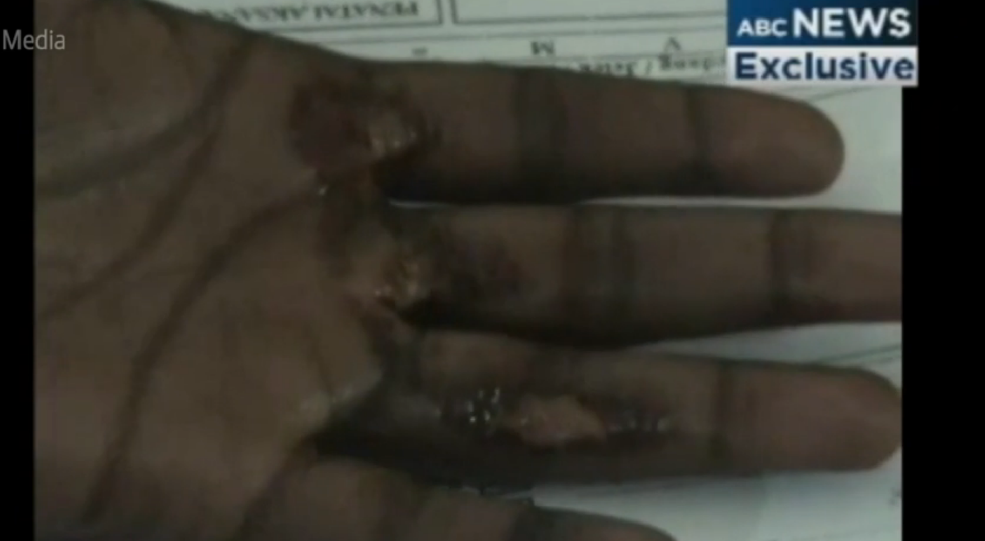 Navy burns: the government's obligation to investigate