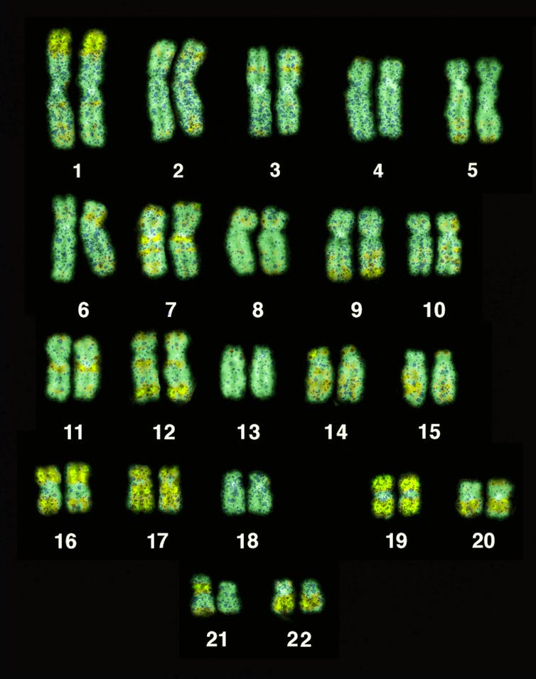 The 22 chromosomes of the human genome.