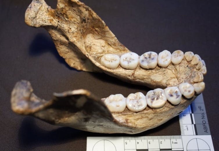 The jawbone of Paranthropus robustus, a fossil hominid.