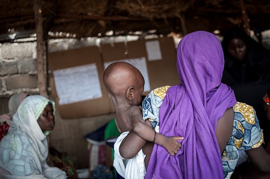 A woman wearing a head wrap holding a baby who appears to be underweight