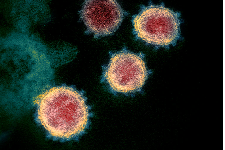 Electron micrograph of SARS-CoV-2