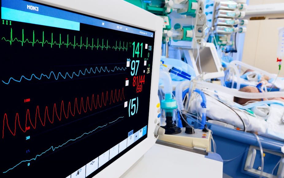 A large screen with numbers monitoring the vitals of a patient
