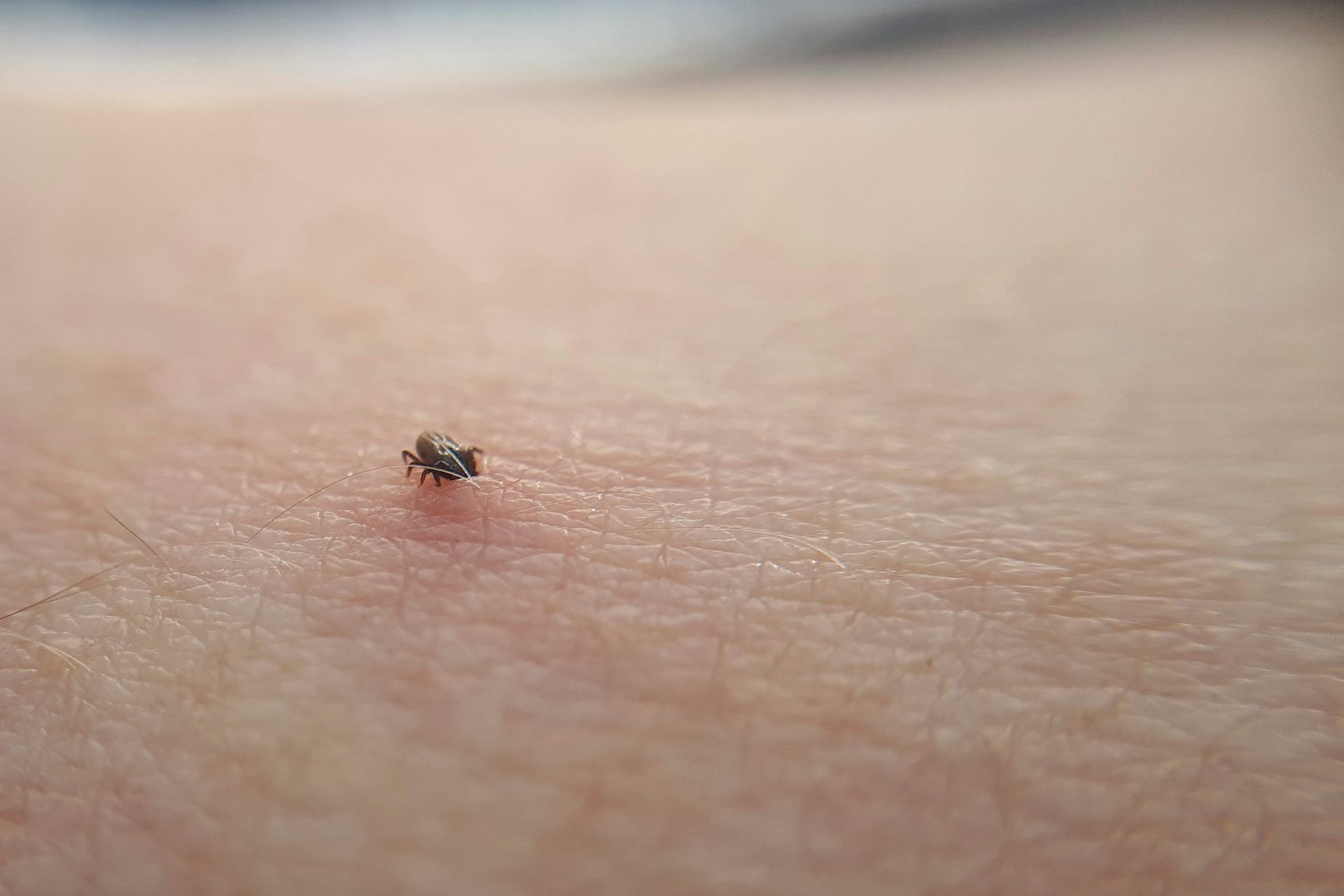 Cómo evitamos que las garrapatas se nos enganchen y transmitan enfermedades?