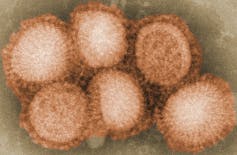 Particelle del virus dell'influenza