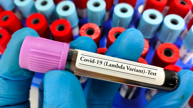 Covid-19: ¿Hay que preocuparse por la variante lambda? Covid-19: ¿Hay que preocuparse por la variante lambda?