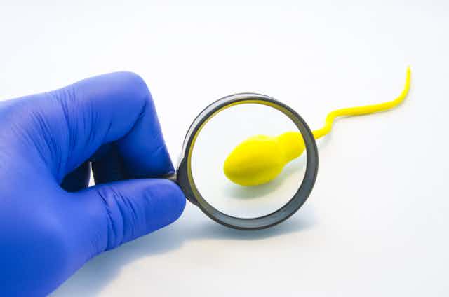 Un chercheur étudie un spermatozoïde.