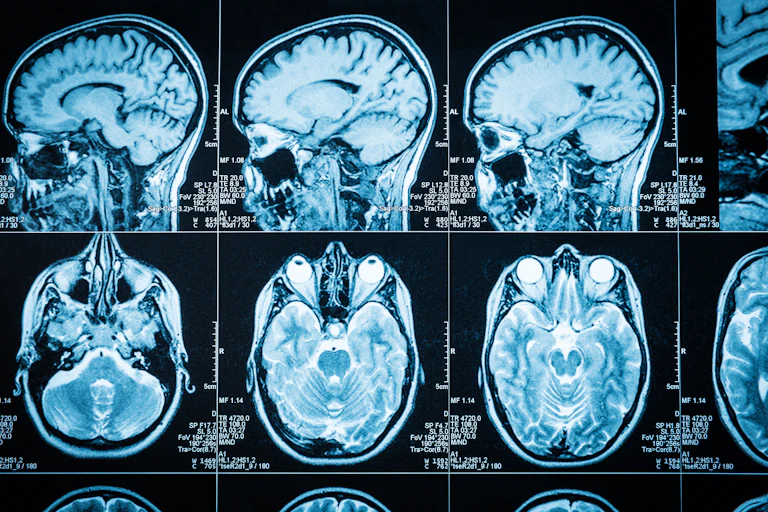 Images of brain scans