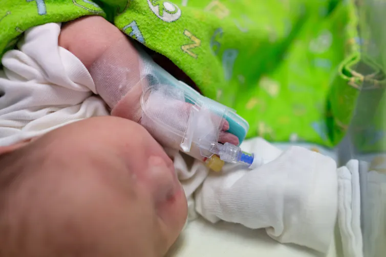 Infant with an intravenous tube on its wrist.