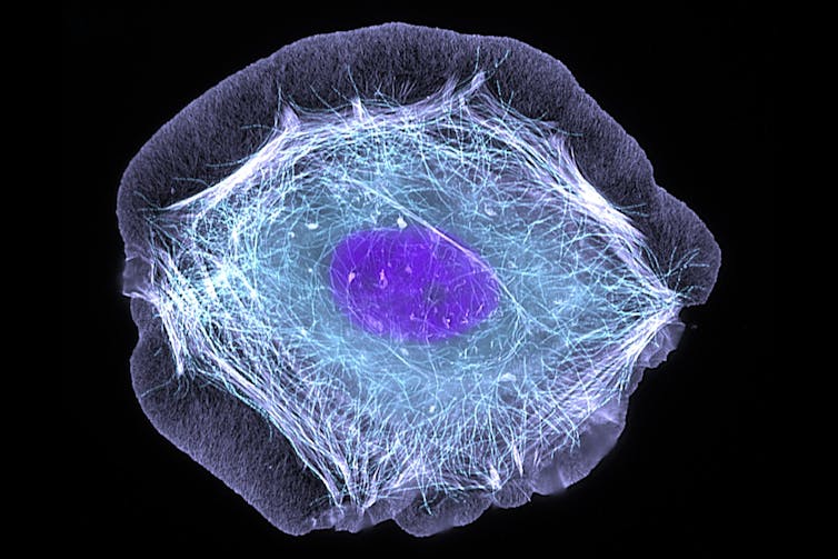 Cellule vue par microscopie, avec corp cellulaire et noyau bien apparents.