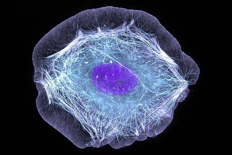 Cellule vue par microscopie, avec corp cellulaire et noyau bien apparents.