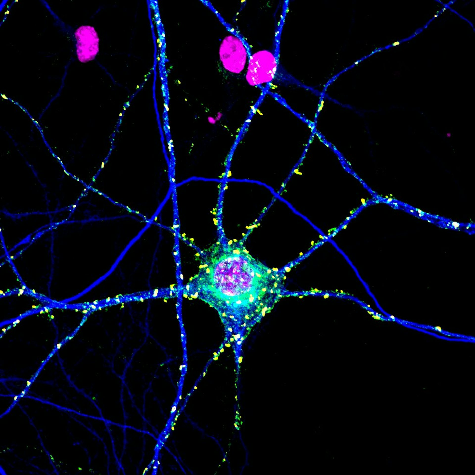Neurone actif
