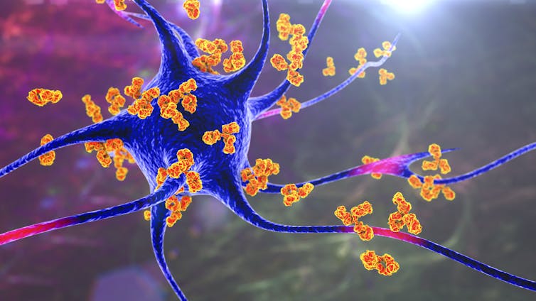 Conceptual illustration of antibodies attacking neurons