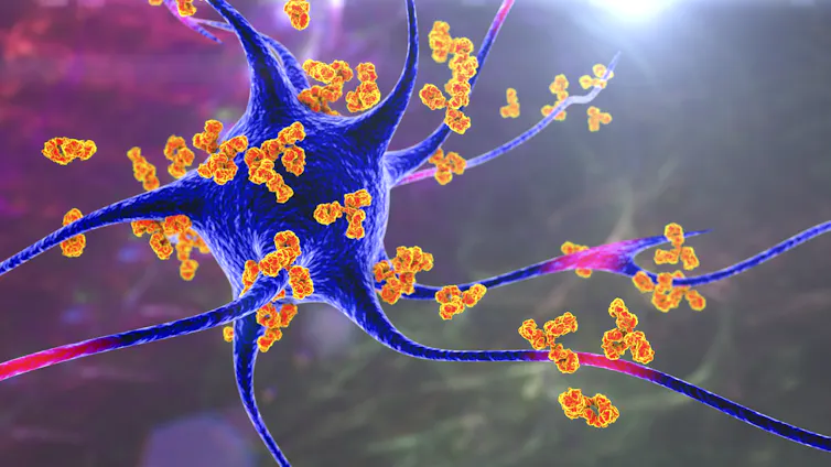 Conceptual illustration of antibodies attacking neurons
