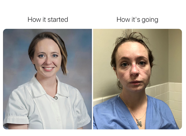 A "How it started/How it's going" meme showing a happy young nurse, and an exhausted nurse in scrubs