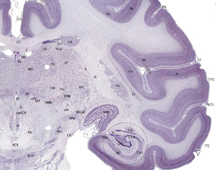 Sezione del cervello dove è visibile il giro dentato dell'ippocampo, circondato da una linea tratteggiata nella parte inferiore dell'immagine.