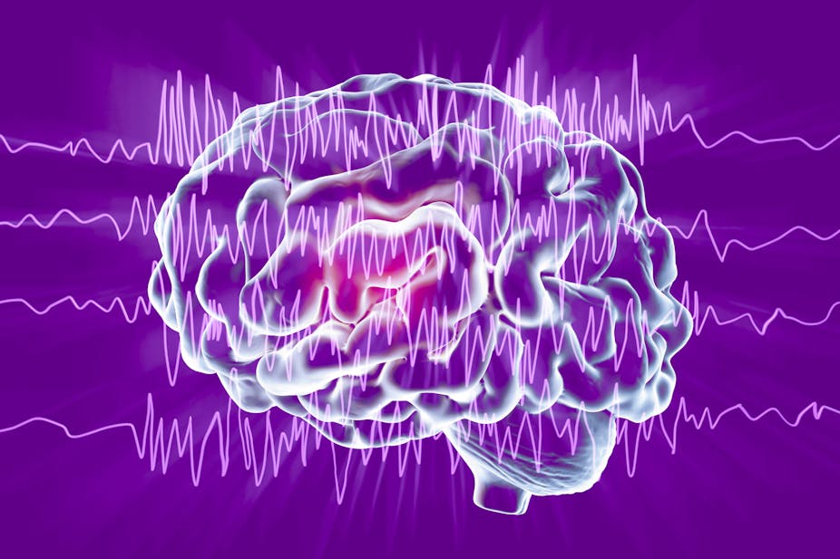 An illustration of a brain and brain waves. 
