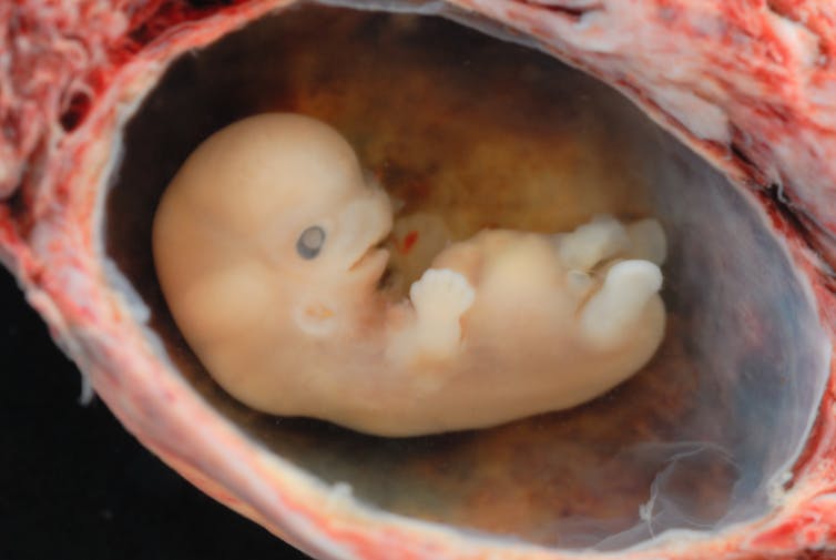 Uma imagem de um feto