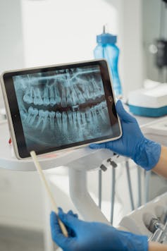 Gloved hands holding an iPad showing a dental X-ray