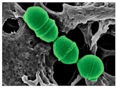 Streptococcus dentisani da microscopia elettronica a colori. 