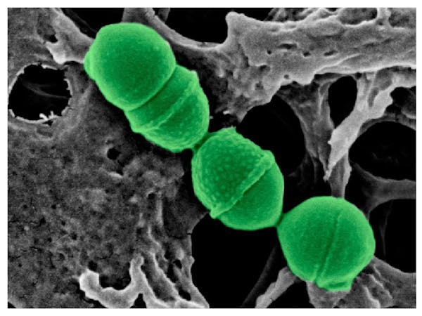 Streptococcus dentisani de microscopía electrónica coloreada. / Anny Camelo Castelo. FISABIO,