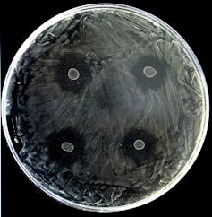 Patóxeno da carie Streptococcus mutans nunha placa Petri. Cultiváronse 4 colonias de S. dentisani e obsérvanse halos de inhibición ao redor das colonias, xa que S. dentisani impide o crecemento do patóxeno. / Luís D. Alcaraz. FISABIO.