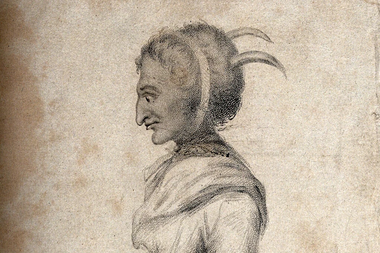 Ann Davis, a woman with smallpox and horns growing out of her head. Stipple engraving by T. Woolnoth, 1806
