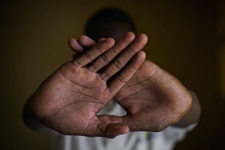 The hands of an unidentified teenage boy who was previously associated with armed militia groups in the Sahel region