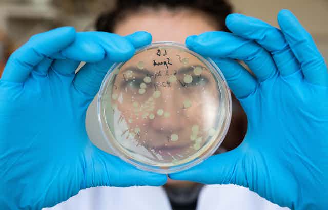 A person looking at a petri dish with colonies of bacteria growing on it