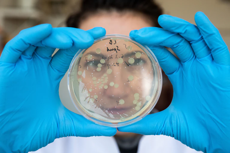 A person looking at a petri dish with colonies of bacteria growing on it