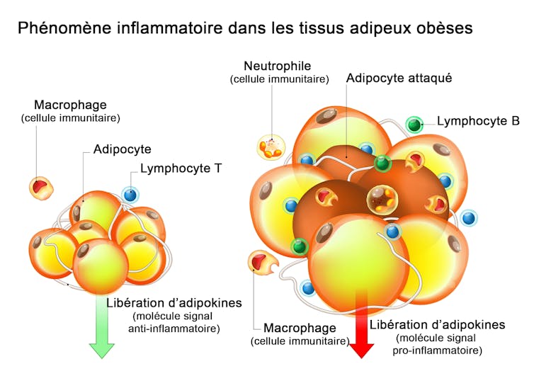 Tissu adipeux et intervention de cellules immunitaires lors d’une inflammation