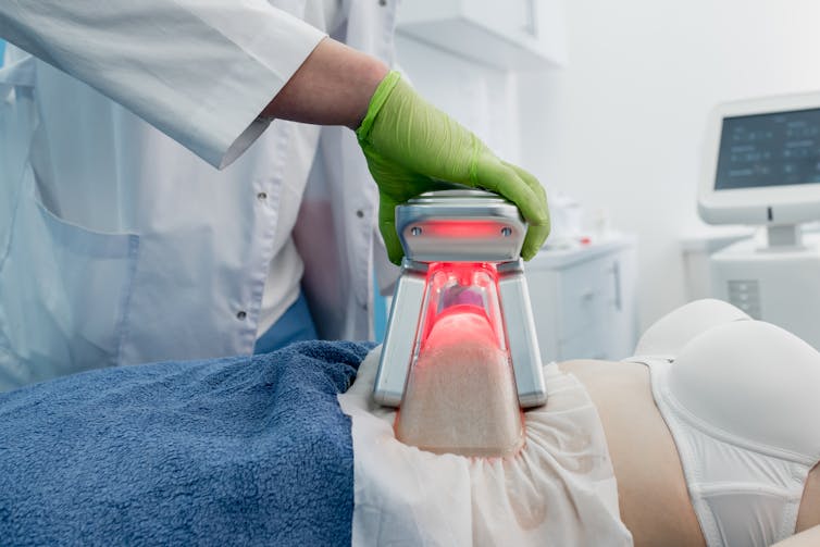 cryolipolysis treatment in progress