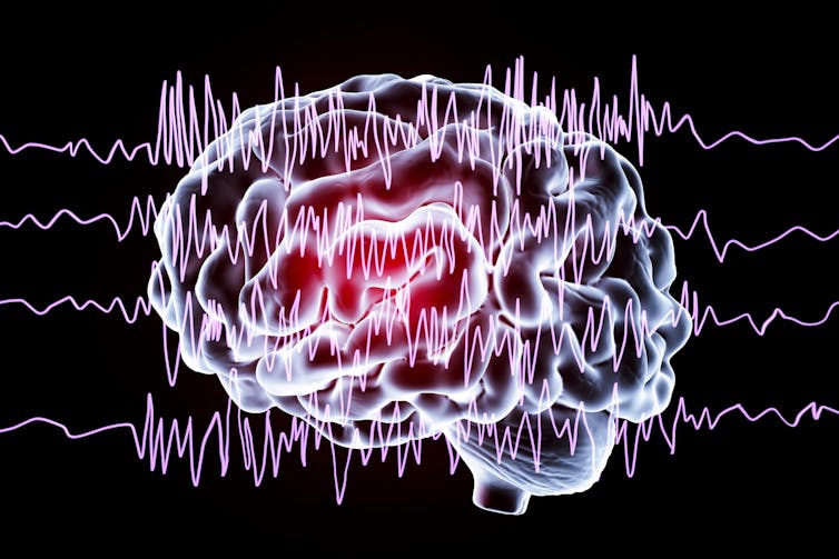 A drawing of a brain set above sound waves.