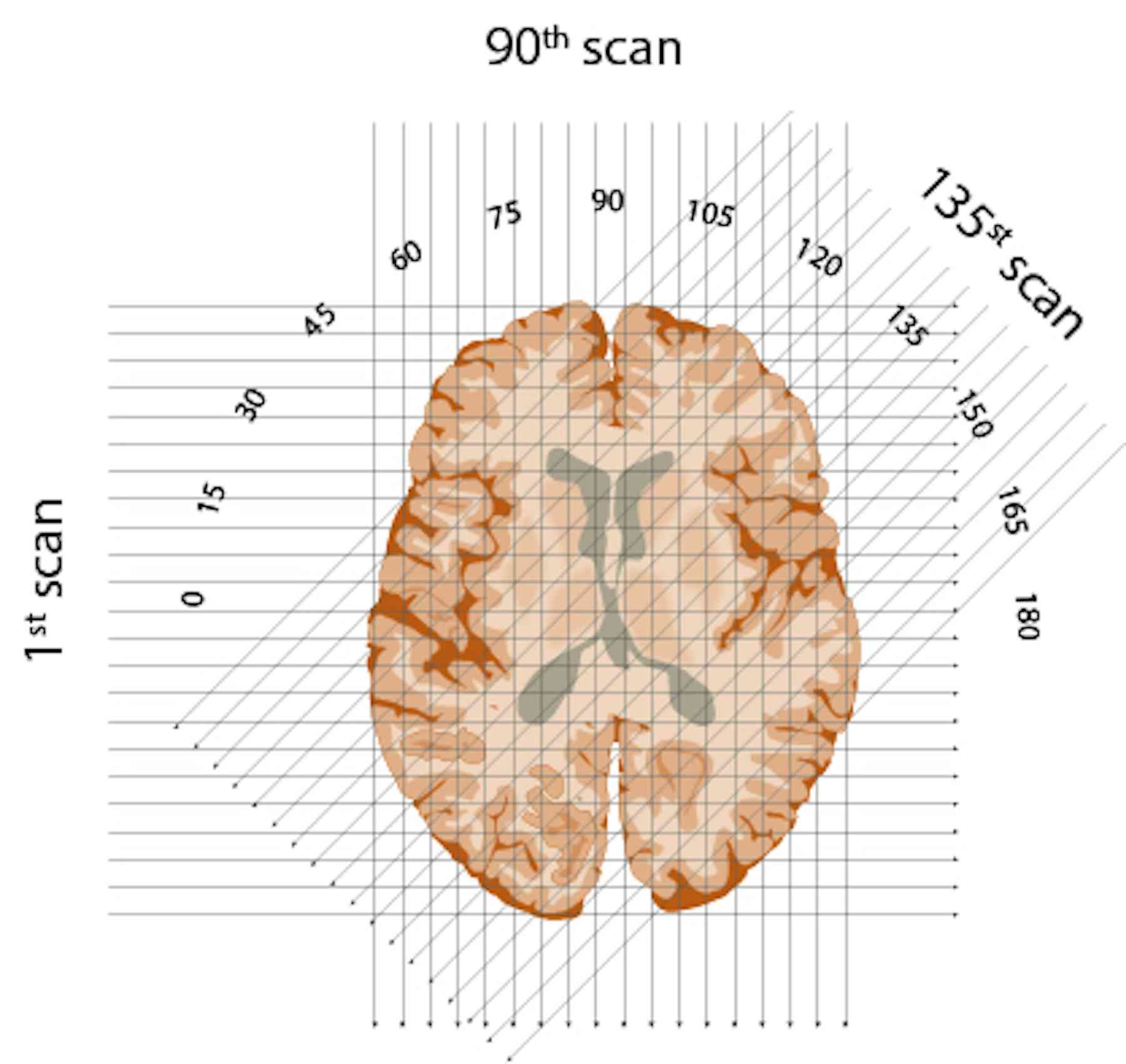 50 years ago, the first CT scan let doctors see inside a living skull ...