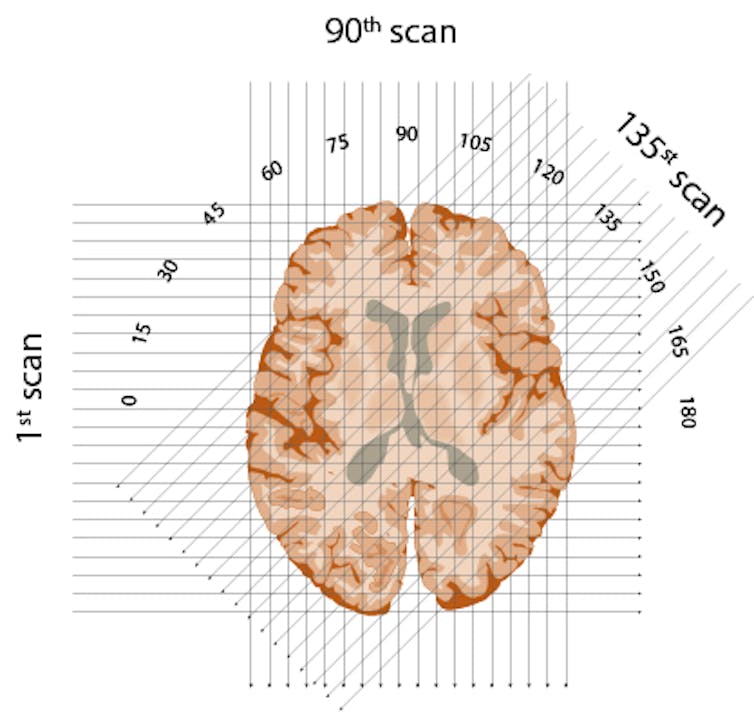 schematic of three X-ray beams through one 'slice' of brain