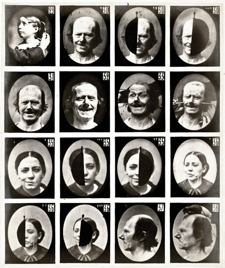Photographie ancienne (XIXᵉ siècle) tirée du _Mécanisme de la physionomie humaine_) du Guillaume Duchenne, avec des visages stimulés électriquement pour repérer les muscles sollicités pour les expressions des émotions