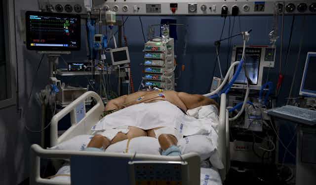 Un hombre obeso con Covid es ingresado en cuidados intensivos.
