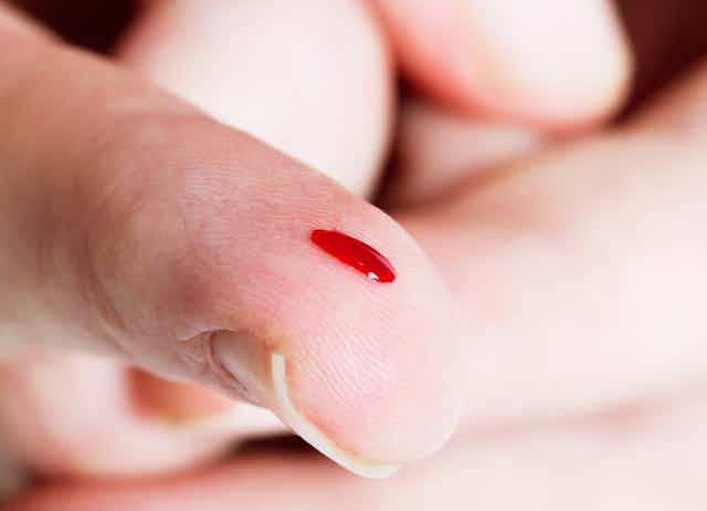 A finger is tended, nail side down, with a drop of blood running toward the tip