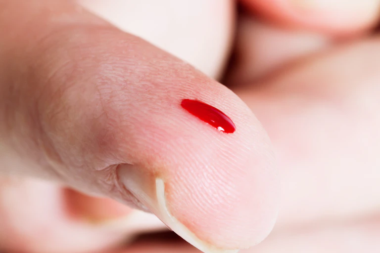 A finger is tended, nail side down, with a drop of blood running toward the tip