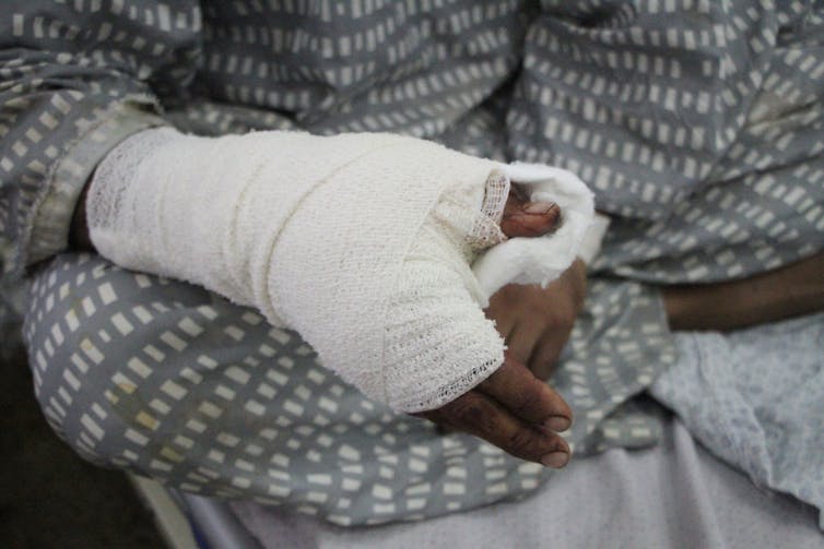 bandaged hands of a person in a hospital gown
