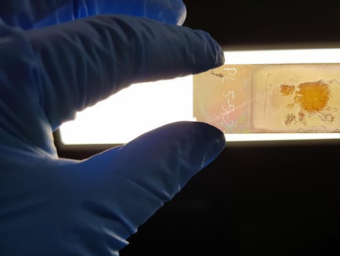 We created a microscope slide that could improve cancer diagnosis, by revealing the 'colour' of cancer cells