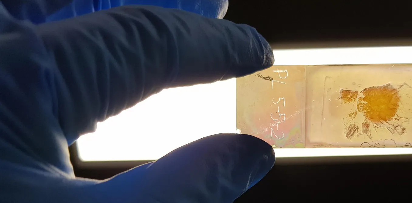 We created a microscope slide that could improve cancer diagnosis, by ...