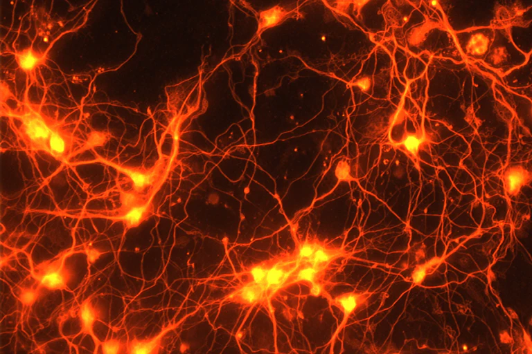 Image of brain connections.