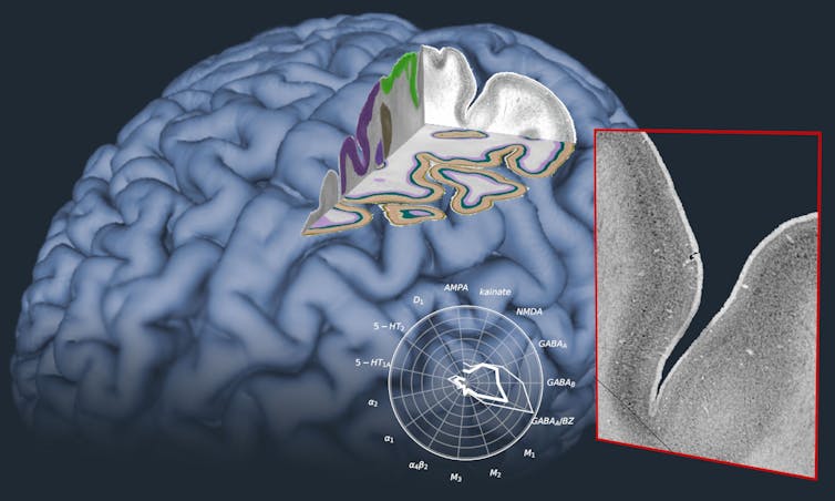 Image of an atlas visualisation.