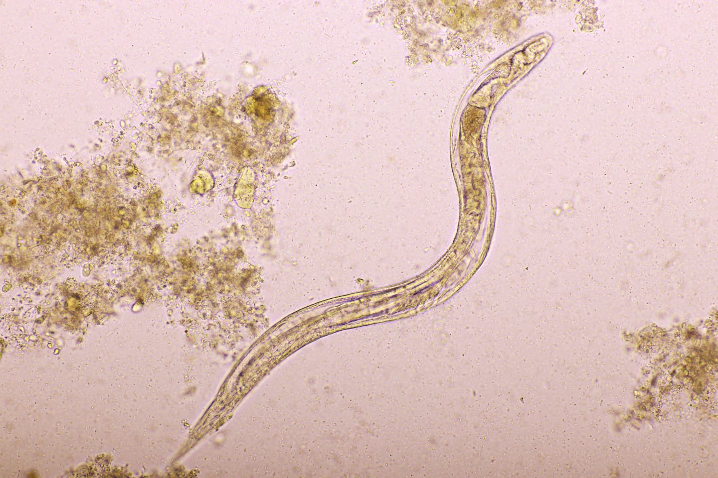 Microscopic image of strongyloides stercoralis in human stool