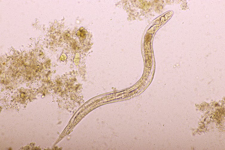 Imagem microscópica de Strongyloides stercoralis em fezes humanas