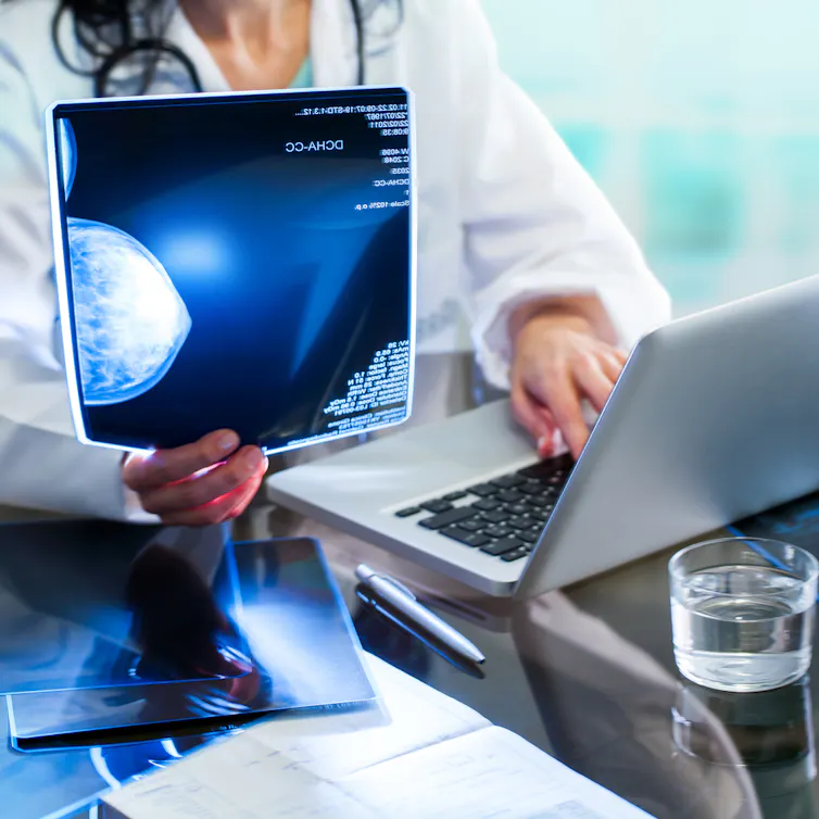 Un médecin tient une mammographie et l’étudie sur son ordinateur