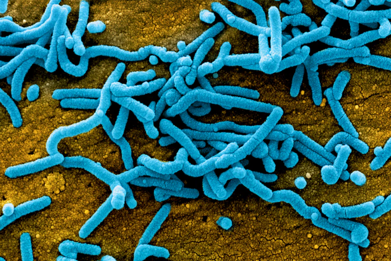 Micrographie électronique à balayage colorisée de particules du virus Marburg bourgeonnant à la surface de cellules infectées.
