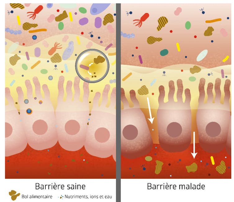 Dessin montrant les effets d’un microbiote altéré