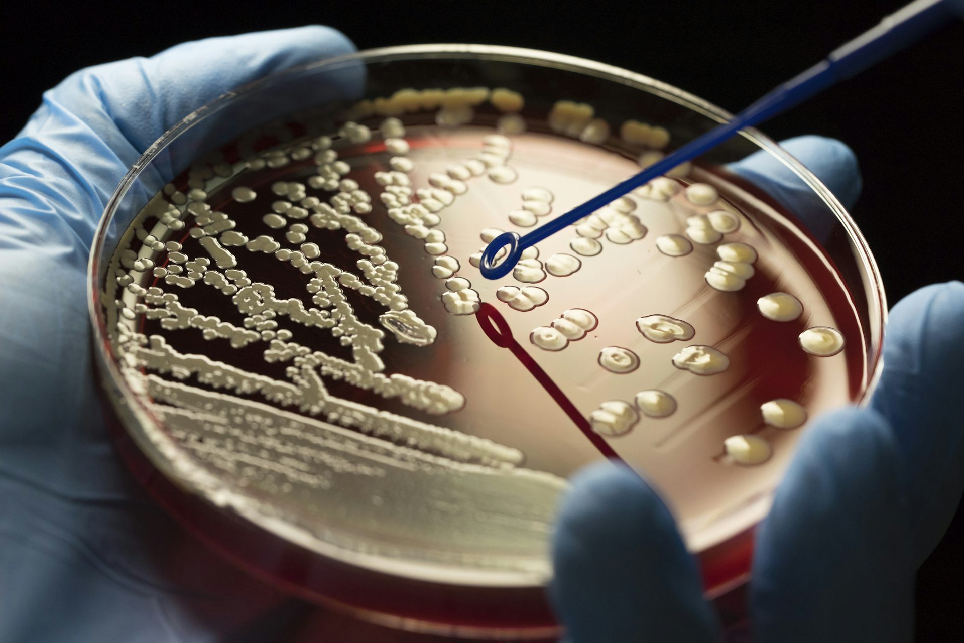 Antibiotic Resistance Is At A Crisis Point – Government Support For ...