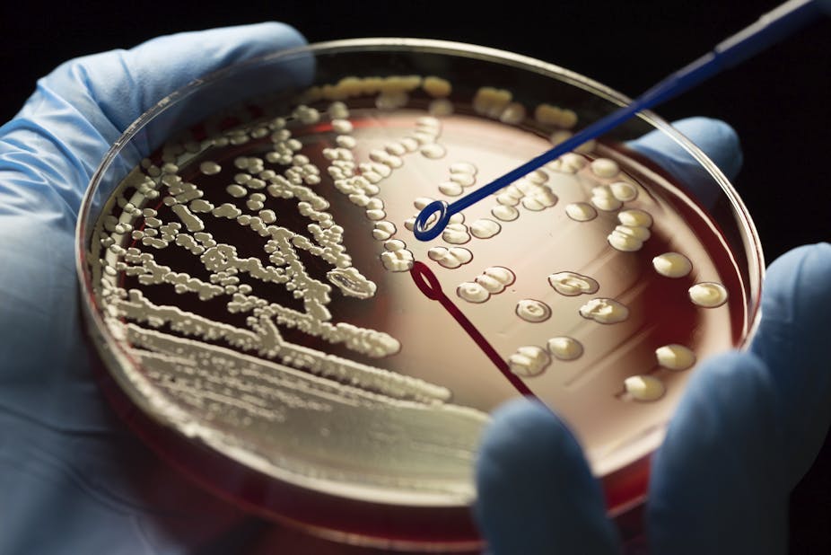 MRSA bacteria colonies on blood agar Petri dish held in loved hand.